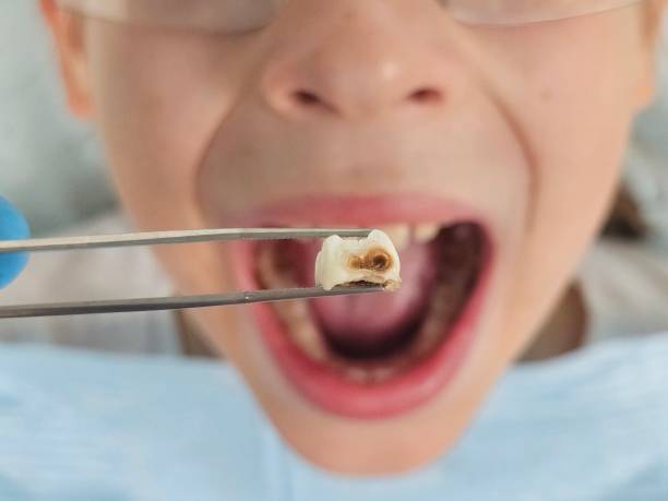 Best 24-Hour Emergency Dental Care in Oquawka, IL