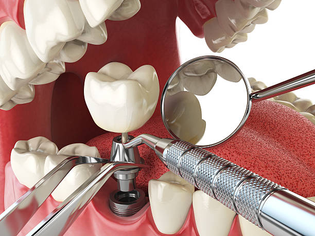 Best Weekend Emergency Dental Services in Oquawka, IL